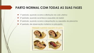 PARTO NORMAL COM TODAS AS SUAS FASES
 1º período, quando ocorre a dilatação do colo uterino;
 2º período, quando acontece a expulsão do bebê;
 3º período, quando ocorre a dequitação ou expulsão da placenta;
 4º período, de observação materna no pós-parto.
 