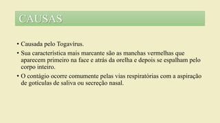 • Causada pelo Togavírus.
• Sua característica mais marcante são as manchas vermelhas que
aparecem primeiro na face e atrás da orelha e depois se espalham pelo
corpo inteiro.
• O contágio ocorre comumente pelas vias respiratórias com a aspiração
de gotículas de saliva ou secreção nasal.
CAUSAS
 
