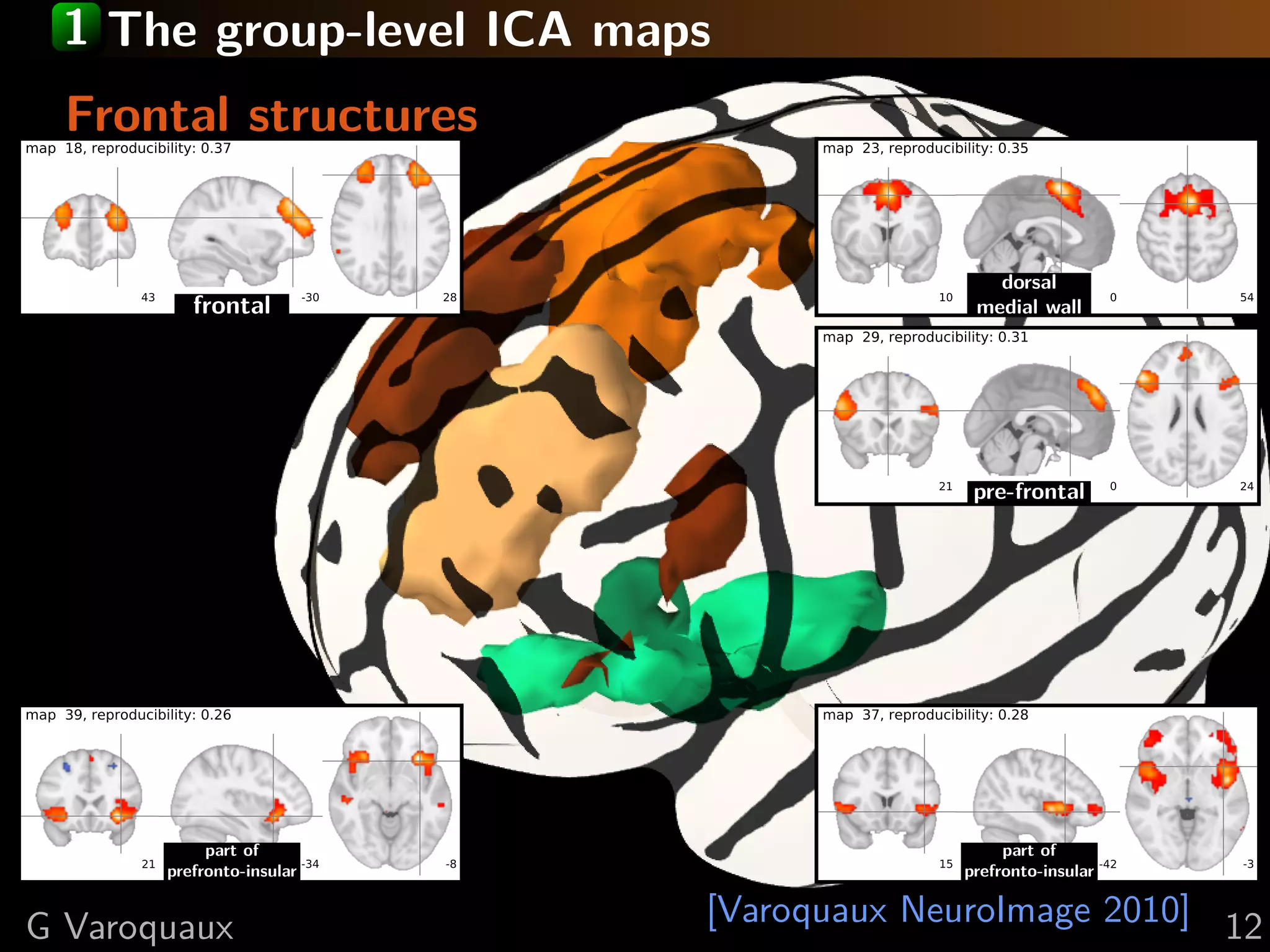 1 The group-level ICA maps
     Frontal structures
map 18, reproducibility: 0.37                         map 23, reproducibility: 0.35




                                                                             dorsal
                43
                       frontal       -30   28                         10
                                                                           medial wall
                                                                                             0   54

                                                      map 29, reproducibility: 0.31




                                                                      21   pre-frontal       0   24




map 39, reproducibility: 0.26                         map 37, reproducibility: 0.28




                        part of                                               part of
                21 prefronto-insular -34   -8                         15 prefronto-insular -42   -3


G Varoquaux                                     [Varoquaux NeuroImage 2010] 12
 