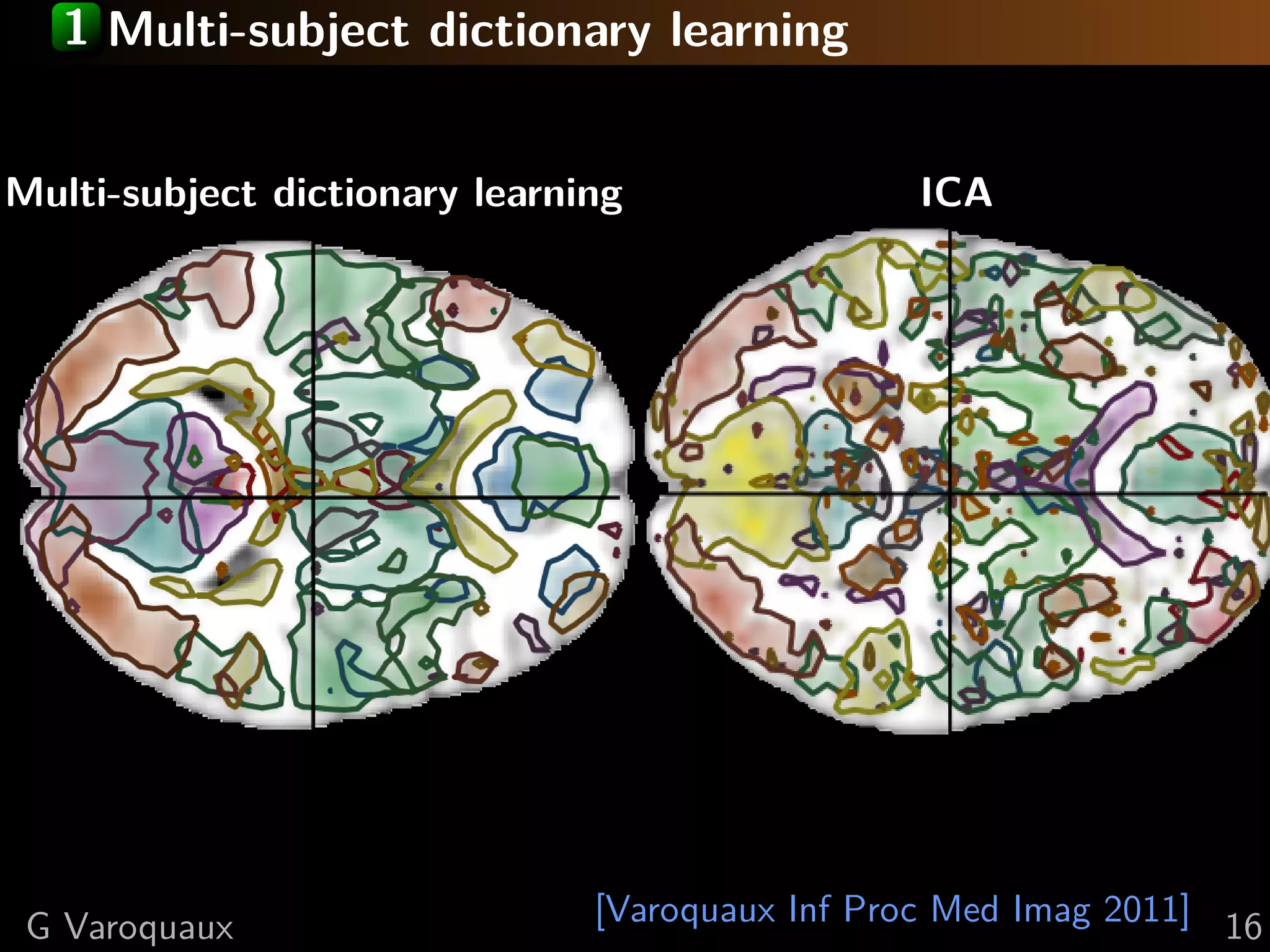 1 Multi-subject dictionary learning


Multi-subject dictionary learning                ICA




 G Varoquaux                   [Varoquaux Inf Proc Med Imag 2011] 16
 