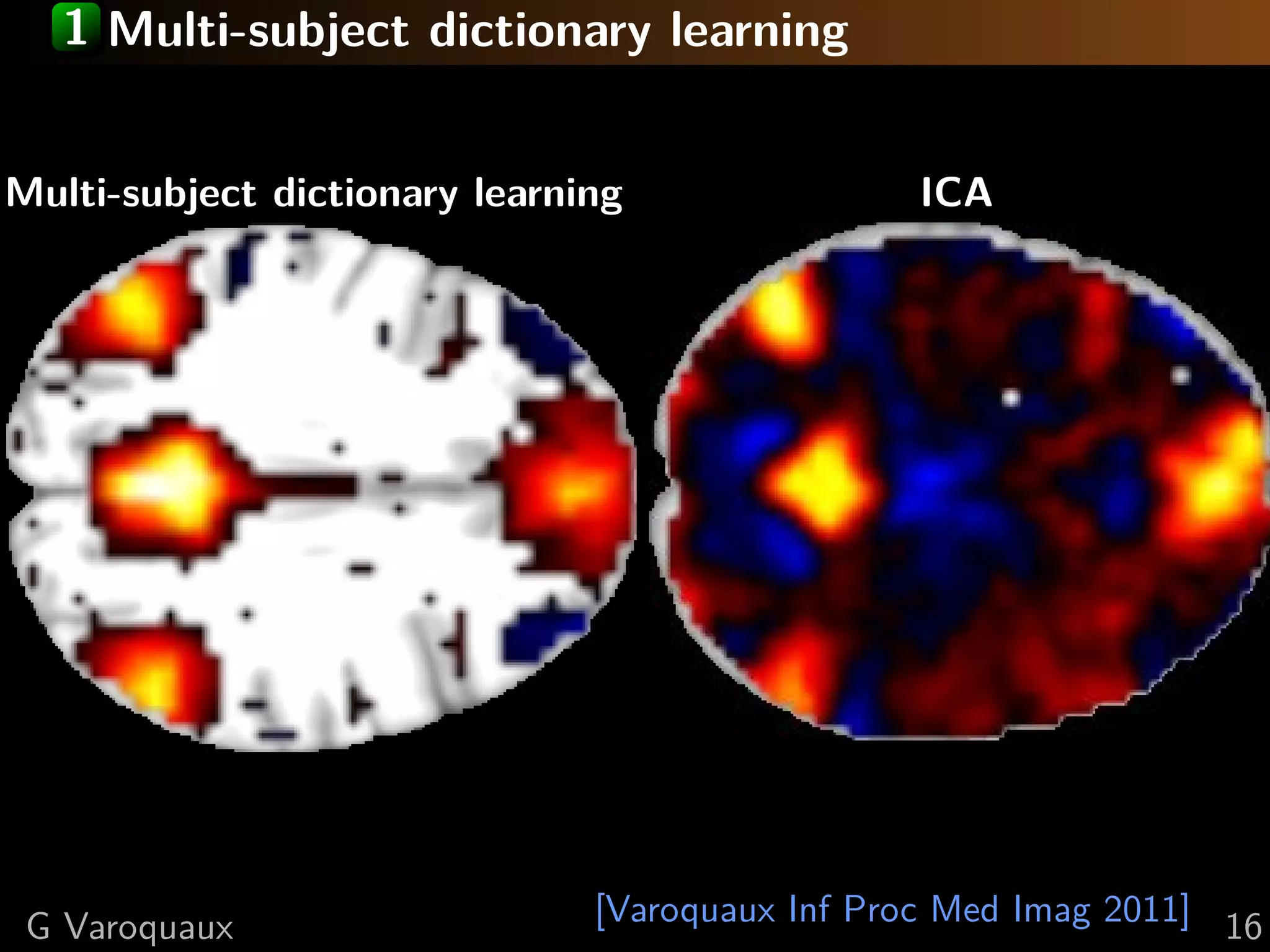 1 Multi-subject dictionary learning


Multi-subject dictionary learning                ICA




 G Varoquaux                   [Varoquaux Inf Proc Med Imag 2011] 16
 