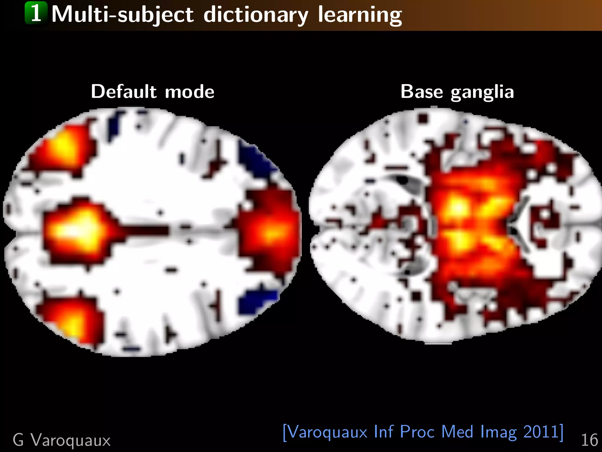 1 Multi-subject dictionary learning


        Default mode                 Base ganglia




G Varoquaux             [Varoquaux Inf Proc Med Imag 2011] 16
 