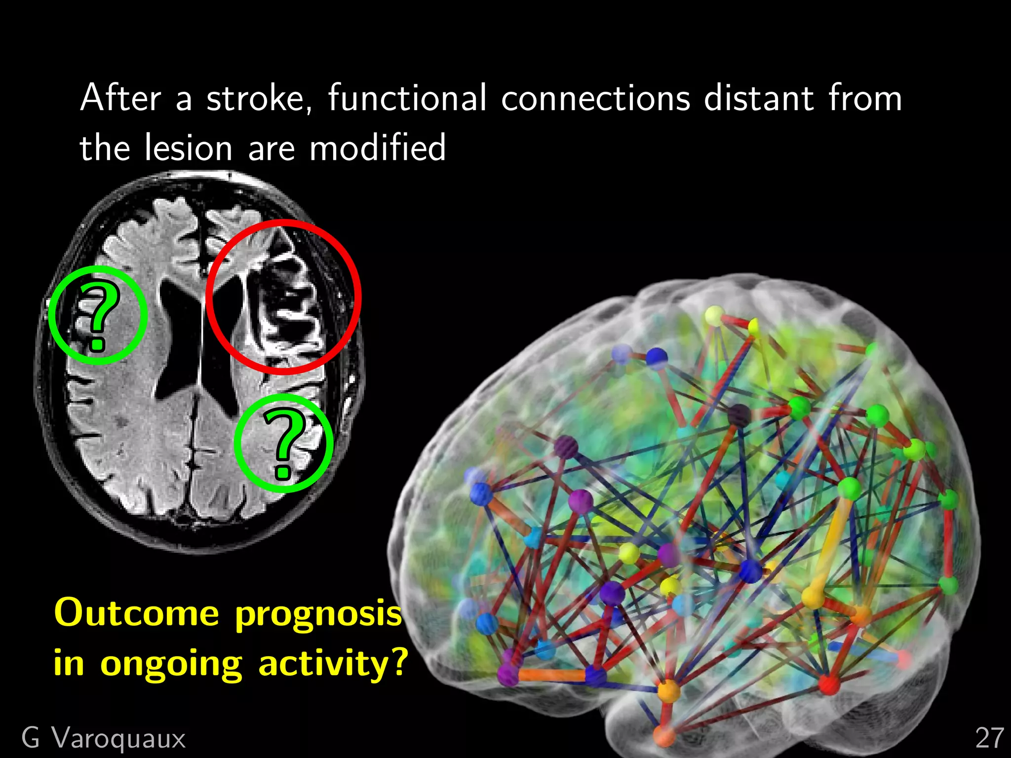 After a stroke, functional connections distant from
   the lesion are modiﬁed



   ?
              ?
  Outcome prognosis
  in ongoing activity?
G Varoquaux                                              27
 
