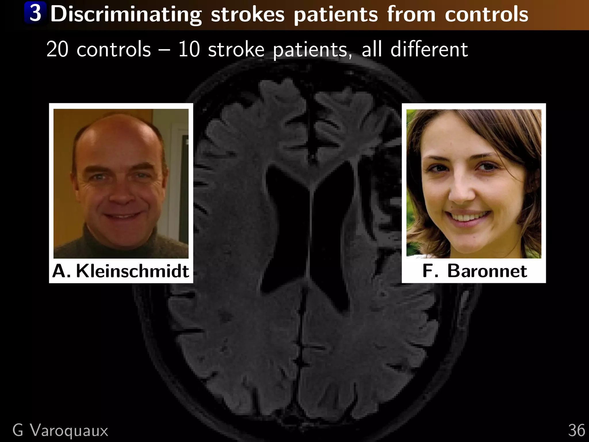 3 Discriminating strokes patients from controls
   20 controls – 10 stroke patients, all diﬀerent




    A. Kleinschmidt                        F. Baronnet




G Varoquaux                                              36
 
