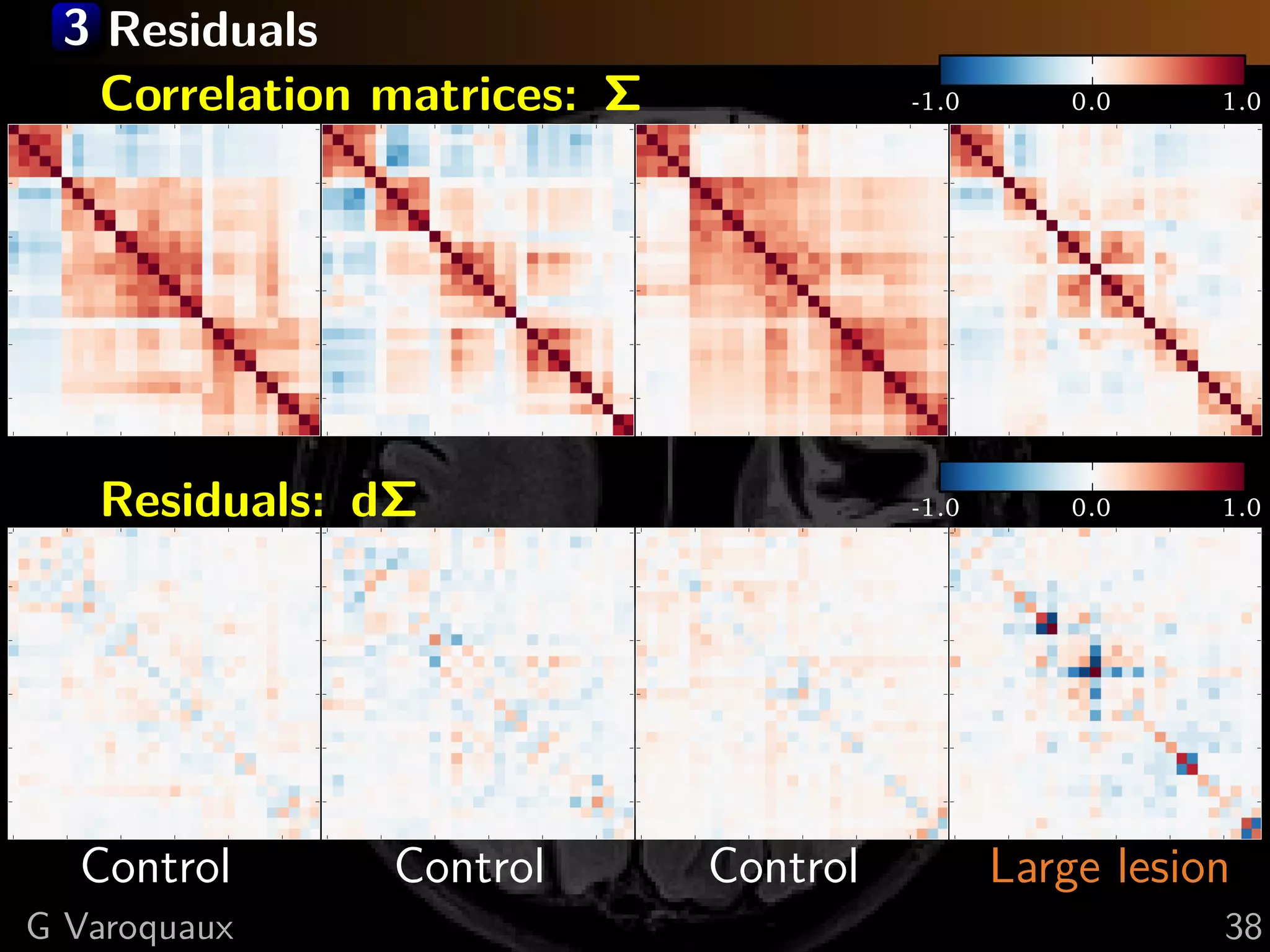 3 Residuals
0
           Correlation matrices: Σ
                     0            0
                                                                                                  -1.0
                                                                                                        0
                                                                                                                     0.0           1.0


5                                   5                                 5                                 5

0                                  10                                10                                10

5                                  15                                15                                15

0                                  20                                20                                20

5                                  25                                25                                25

    0     5    10   15   20   25        0   5    10   15   20   25        0   5    10   15   20   25        0   5   10   15   20   25



0
              Residuals: dΣ
                       0                                             0
                                                                                                  -1.0
                                                                                                       0
                                                                                                                     0.0           1.0

5                                   5                                 5                                 5

0                                  10                                10                                10

5                                  15                                15                                15

0                                  20                                20                                20

5                                  25                                25                                25

    0     5    10   15   20   25        0   5    10   15   20   25        0   5    10   15   20   25        0   5   10   15   20   25
              Control                           Control                           Control                       Large lesion
        G Varoquaux                                                                                                                38
 