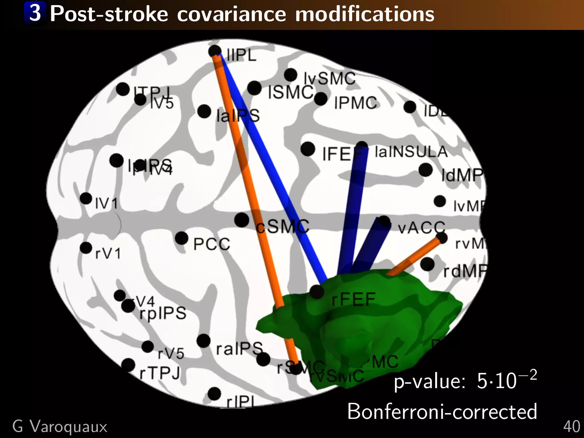 3 Post-stroke covariance modiﬁcations




                                 p-value: 5·10−2
                             Bonferroni-corrected
G Varoquaux                                         40
 