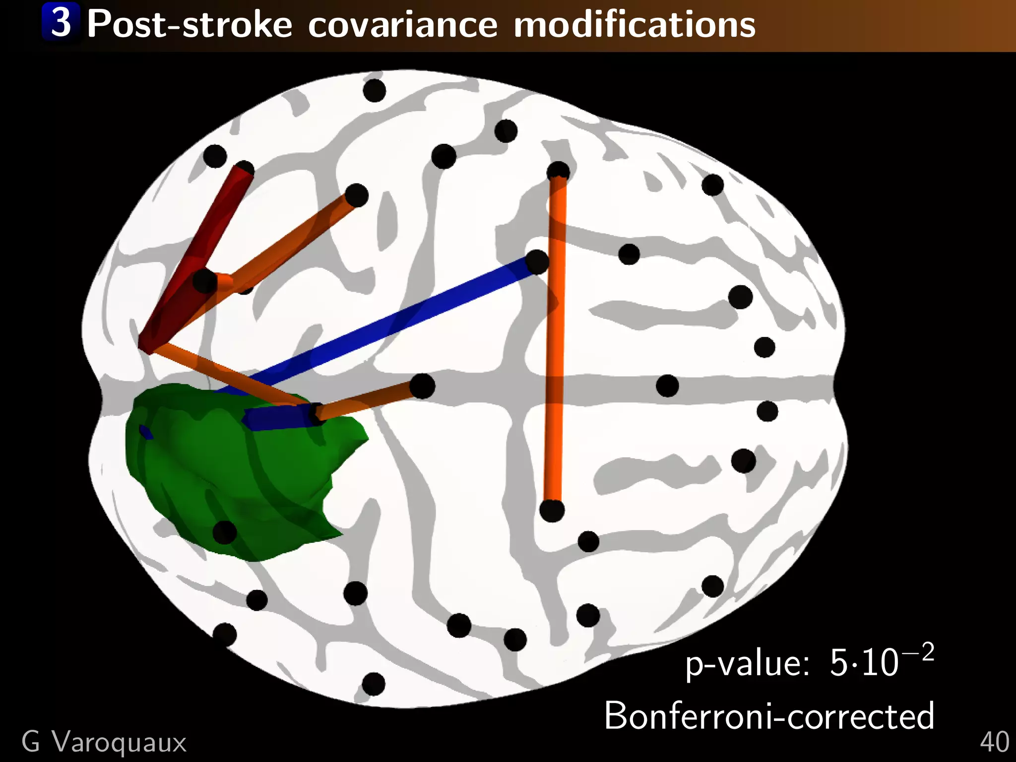 3 Post-stroke covariance modiﬁcations




                                 p-value: 5·10−2
                             Bonferroni-corrected
G Varoquaux                                         40
 