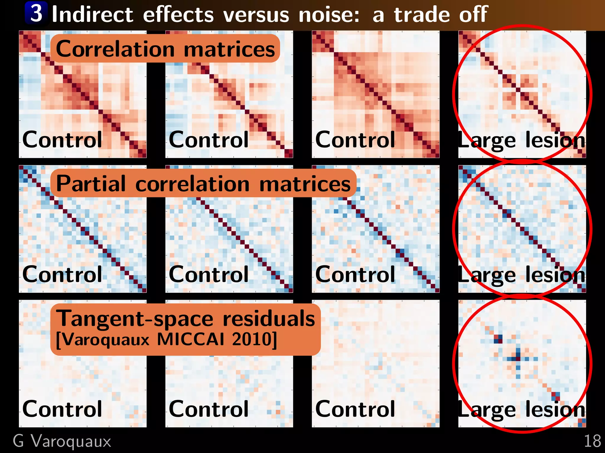 3 Indirect eﬀects versus noise: a trade oﬀ
0                                 0                                0                                0

 5          Correlation matrices   5                                5                                5

10                                10                               10                               10

15                                15                               15                               15

20                                20                               20                               20

25   Control                      25   Control                     25   Control                      Large lesion
                                                                                                    25

     0    5   10   15   20   25        0   5   10   15   20   25        0   5   10   15   20   25        0   5   10   15   20   25
0                                 0                                0                                0

 5            Partial correlation matrices
                                   5                                5                                5

10                                10                               10                               10

15                                15                               15                               15

20                                20                               20                               20

25   Control                      25   Control                     25   Control                      Large lesion
                                                                                                    25

     0    5   10   15   20   25        0   5   10   15   20   25        0   5   10   15   20   25        0   5   10   15   20   25
0                                 0                                0                                0

 5            Tangent-space residuals
                                   5                                5                                5

10            [Varoquaux MICCAI 2010]
                         10                                        10                               10

15                                15                               15                               15

20                                20                               20                               20

25   Control                      25   Control                     25   Control                      Large lesion
                                                                                                    25

     0    5   10   15   20   25        0   5   10   15   20   25        0   5   10   15   20   25        0   5   10   15   20   25
G Varoquaux                                                                                                                          18
 