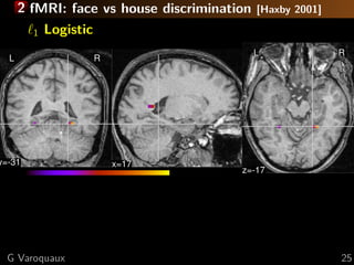 2 fMRI: face vs house discrimination   [Haxby 2001]

        1   Logistic
                                             L              R
  L                    R




y=-31                      x=17
                                        z=-17




  G Varoquaux                                               25
 