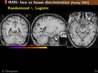 2 fMRI: face vs house discrimination   [Haxby 2001]
        Randomized   1   Logistic
                                             L              R
  L              R




y=-31                x=17
                                        z=-17




  G Varoquaux                                               25
 