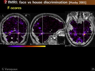 2 fMRI: face vs house discrimination   [Haxby 2001]
        F-scores
                                             L              R
  L                R




y=-31                  x=17
                                        z=-17




  G Varoquaux                                               25
 