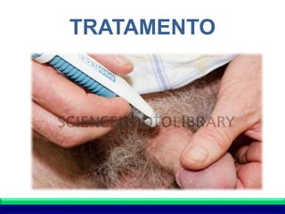 TRATAMENTO
 