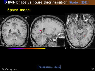 3 fMRI: face vs house discrimination [Haxby... 2001]
[Varoquaux... 2012]
Sparse model
L R
y=-31 x=17
L R
z=-17
G Varoquaux 25
 