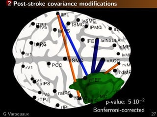 2 Post-stroke covariance modiﬁcations
p-value: 5·10−2
Bonferroni-corrected
G Varoquaux 27
 