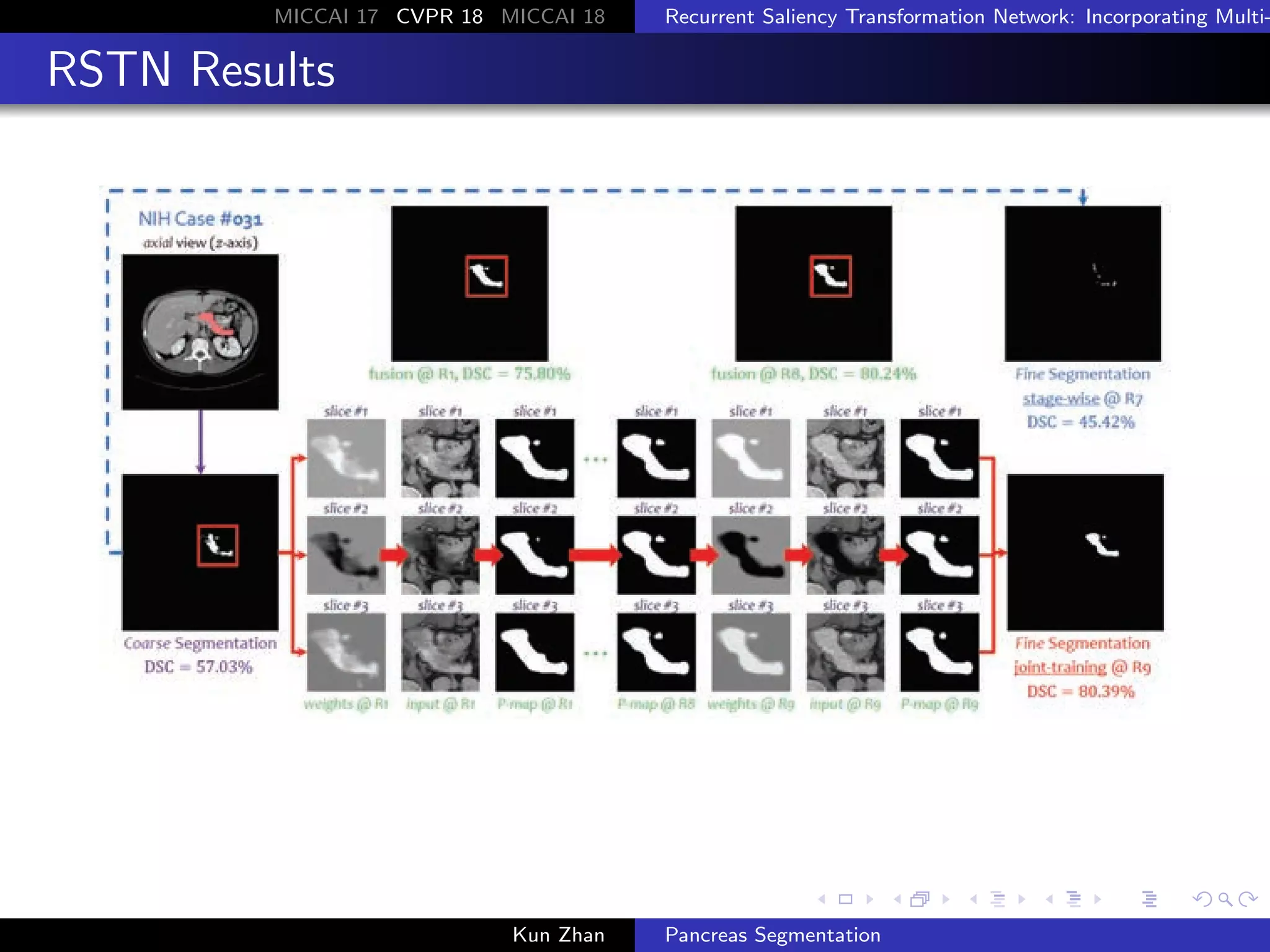 Pancreas Segmentation | PDF