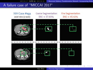 MICCAI 17 CVPR 18 MICCAI 18 Recurrent Saliency Transformation Network: Incorporating Multi-
A failure case of “MICCAI 2017...