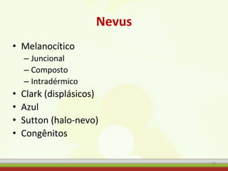 Nevus
• Melanocítico
– Juncional
– Composto
– Intradérmico
• Clark (displásicos)
• Azul
• Sutton (halo-nevo)
• Congênitos
10
 