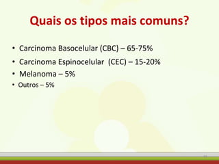 Quais os tipos mais comuns?
• Carcinoma Basocelular (CBC) – 65-75%
• Carcinoma Espinocelular (CEC) – 15-20%
• Melanoma – 5%
• Outros – 5%
49
 
