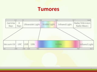 Tumores
5
 