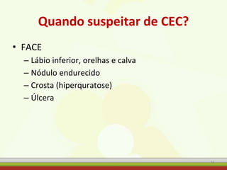 Quando suspeitar de CEC?
• FACE
– Lábio inferior, orelhas e calva
– Nódulo endurecido
– Crosta (hiperquratose)
– Úlcera
56
 