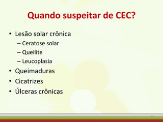 Quando suspeitar de CEC?
• Lesão solar crônica
– Ceratose solar
– Queilite
– Leucoplasia
• Queimaduras
• Cicatrizes
• Úlceras crônicas
57
 