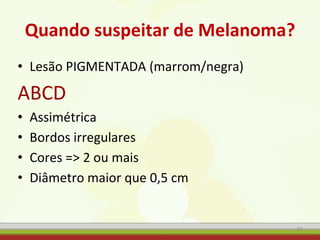 Quando suspeitar de Melanoma?
• Lesão PIGMENTADA (marrom/negra)
ABCD
• Assimétrica
• Bordos irregulares
• Cores => 2 ou mais
• Diâmetro maior que 0,5 cm
59
 