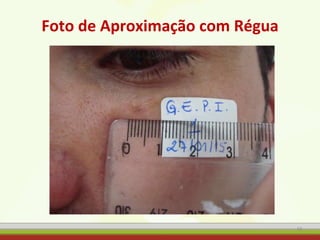 Foto de Aproximação com Régua
65
 