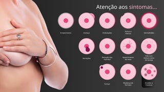 Erosões e
Coceiras
Mudança de
formato
Caroço
Pele com
textura casca
de laranja
Aparecimento
de veias
Retração dos
mamilos
Secreções
Vermelhidão
Sulcos e
marcas
Ondulações
Inchaço
Enrijecimento
!!
Atenção aos sintomas...
 