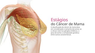 Estágios
do Câncer de Mama
A classificação do câncer de mama leva
em consideração o tamanho do tumor, se
o câncer está nos gânglios linfáticos, o
grau do tumor, a composição genética
entre outras características.
 