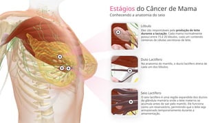 Estágios do Câncer de Mama
Conhecendo a anatomia do seio
Lóbulo
Duto Lactífero
Seio Lactífero
Na anatomia do mamilo, o ducto lactífero drena de
cada um dos lóbulos.
Eles são responsáveis pela produção de leite
durante a lactação. Cada mama normalmente
possui entre 15 e 20 lóbulos, cada um contendo
centenas de células secretoras de leite.
O seio lactífero é uma região expandida dos ductos
da glândula mamária onde o leite materno se
acumula antes de sair pelo mamilo. Ele funciona
como um reservatório, permitindo que o leite seja
armazenado temporariamente durante a
amamentação.
 
