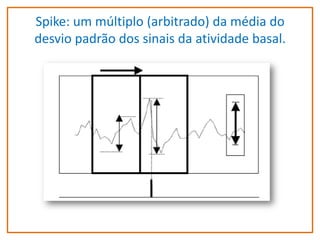 Spike: um múltiplo (arbitrado) da média do
desvio padrão dos sinais da atividade basal.

 