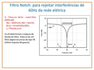 Filtro Notch: para rejeitar interferências de
60Hz da rede elétrica
% Filtra em 60 Hz - notch filter
(MATLAB)
Wo = 60/(Fs/2); BW = Wo/35;
[b,a] = iirnotch(Wo,BW);
y = filter(b,a,m);
A e B determinam a largura de
banda do filtro. Trata-se de um
filtro digital recursivo do tipo IIR
(Infinit Impulse Response)

 