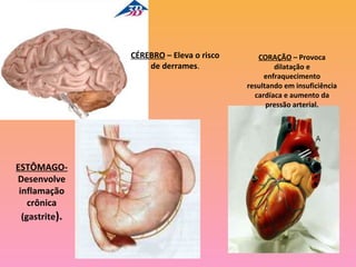 CÉREBRO – Eleva o risco      CORAÇÃO – Provoca
                    de derrames.                  dilatação e
                                               enfraquecimento
                                          resultando em insuficiência
                                            cardíaca e aumento da
                                                pressão arterial.




ESTÔMAGO-
Desenvolve
 inflamação
    crônica
  (gastrite).
 