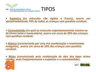 TIPOS
• Espástica (os músculos são rígidos e fracos), ocorre em
aproximadamente 70% de todas as crianças com paralisia cerebral;
• Coreoatetóide (na qual os músculos espontaneamente movem-se
de forma lenta e involuntária), ocorre em cerca de 20% das crianças
com paralisia cerebral;
• Atáxica (caracterizada por uma má coordenação e movimentos
inseguros), ocorre em cerca de 10% das crianças com paralisia
cerebral;
• Mista (caracterizada pela combinação de dois dos tipos acima
citados, mais freqüentemente o espástico e o coreoatetóide).
 