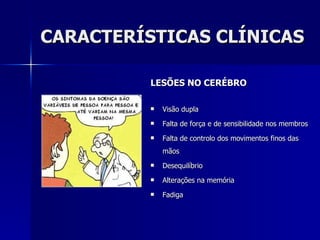 CARACTERÍSTICAS CLÍNICAS LESÕES NO CERÉBRO Visão dupla Falta de força e de sensibilidade nos membros Falta de controlo dos movimentos finos das mãos Desequilíbrio Alterações na memória Fadiga 