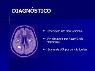 DIAGNÓSTICO Observação dos sinais clínicos  IRM (Imagens por Ressonância Magnética) Exame de LCR por punção lombar  