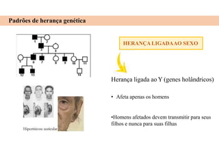 Padrões de herança genética
HERANÇA LIGADAAO SEXO
Herança ligada ao Y (genes holândricos)
• Afeta apenas os homens
•Homens afetados devem transmitir para seus
filhos e nunca para suas filhas
 