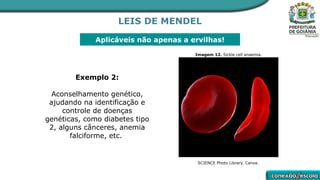 LEIS DE MENDEL
Aplicáveis não apenas a ervilhas!
Exemplo 2:
Aconselhamento genético,
ajudando na identificação e
controle de doenças
genéticas, como diabetes tipo
2, alguns cânceres, anemia
falciforme, etc.
Imagem 12. Sickle cell anaemia.
SCIENCE Photo Library. Canva.
 
