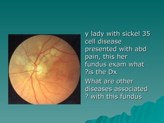35 y lady with sickel cell disease presented with abd pain, this her fundus exam what is the Dx? What are other diseases associated with this fundus ? 