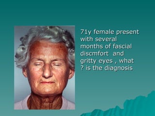 71y female present with several months of fascial discmfort  and gritty eyes , what is the diagnosis ? 