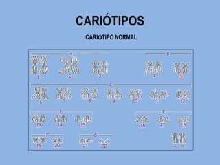 CARIÓTIPOS 
CARIÓTIPO NORMAL  
