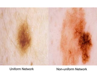 Uniform Network   Non-uniform Network
 