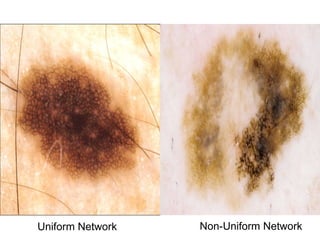 Uniform Network   Non-Uniform Network
 