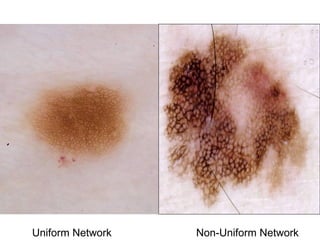 Uniform Network   Non-Uniform Network
 