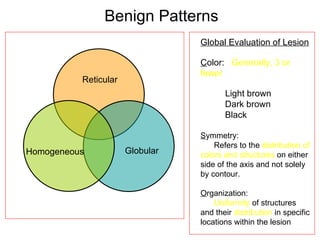 Benign Patterns
*                                                       Global Evaluation of Lesion

                                                        Color: Generally, 3 or
                                                        fewer
                     Reticular
                                                               Light brown
                                                               Dark brown
                                                               Black

                                                        Symmetry:
                                                            Refers to the distribution of
     Homogeneous                  Globular              colors and structures on either
                                                        side of the axis and not solely
                                                        by contour.

                                                        Organization:
                                                            Uniformity of structures
                                                        and their distribution in specific
* Adapted from Hofmann-Wellenhof R, Blum A, Wolff IH,   locations within the lesion
Soyer HP et al (2001) Arch Dermatol 137: 1575-1580
 