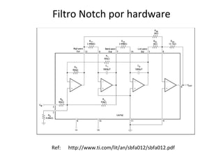 Filtro Notch por hardware

Ref:

http://www.ti.com/lit/an/sbfa012/sbfa012.pdf

 