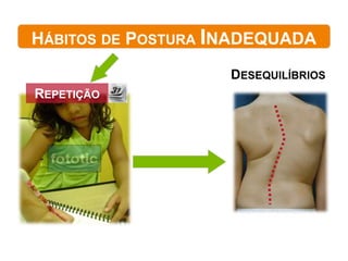 HÁBITOS DE POSTURA INADEQUADA
                    DESEQUILÍBRIOS
REPETIÇÃO
 