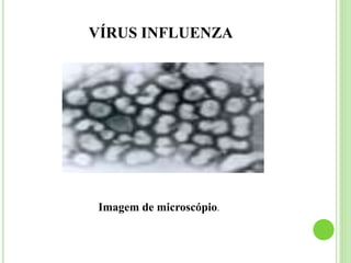 VÍRUS INFLUENZA
Imagem de microscópio.
 