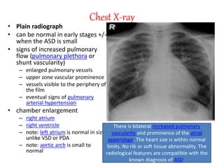 Chest X-ray
• Plain radiograph
• can be normal in early stages +/-
when the ASD is small
• signs of increased pulmonary
flow (pulmonary plethora or
shunt vascularity)
– enlarged pulmonary vessels
– upper zone vascular prominence
– vessels visible to the periphery of
the film
– eventual signs of pulmonary
arterial hypertension
• chamber enlargement
– right atrium
– right ventricle
– note: left atrium is normal in size
unlike VSD or PDA
– note: aortic arch is small to
normal
There is bilateral increased pulmonary
vascularity and prominence of the atrial
appendage. The heart size is within normal
limits. No rib or soft tissue abnormality. The
radiological features are compatible with the
known diagnosis of ASD.
 