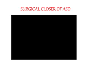 SURGICAL CLOSER OF ASD
 